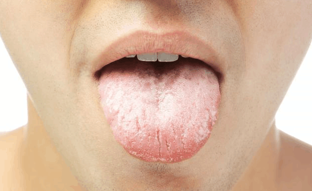 每天清晨, 对舌头做1事! 可降血压、防脑梗, 到老不痴呆!