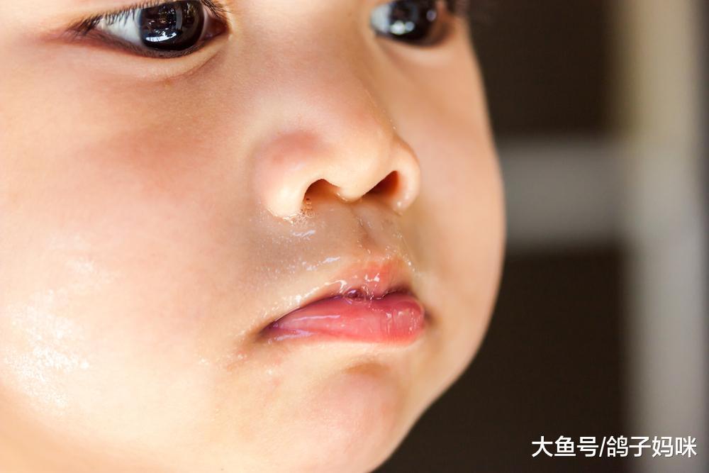 宝宝黄鼻涕代表感冒变严重了? 错, 别急着吃抗生素!