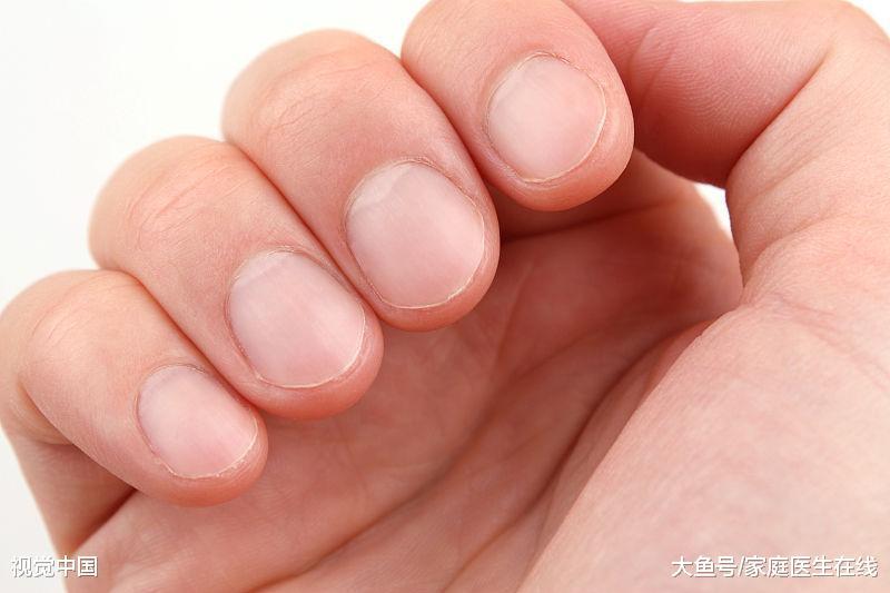正常人指甲底部白色的半圆弧状的部分成为月牙.