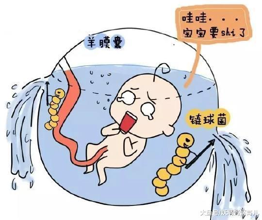 什么是孕期破水? 高位破水的5大明显特征, 你知道几个