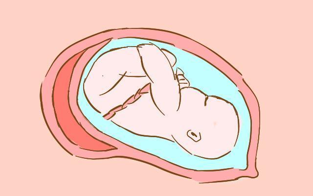 胎宝宝脐带绕颈, 大多与这3个原因有关系, 孕妈要尽早避免