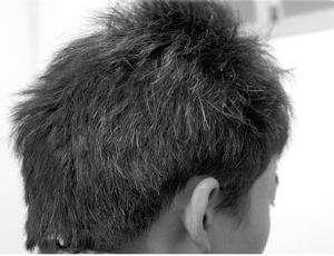 为何有“少年白发”? 可能是你这里出问题了, 不注意就得后悔了!