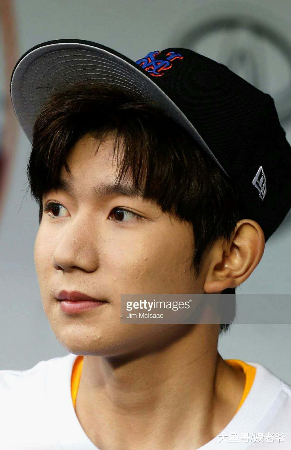 明星的皮肤也有这么多小瑕疵, 最后一个甚至有点吓人?