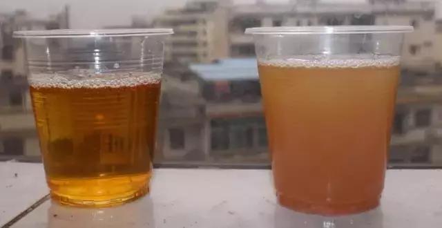 肝好不好, 看看小便的颜色! 平常做好6件事, 肝脏越来越好