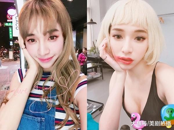 台湾第一伪娘, 花20万丰胸整容成baby! 分手后后悔变性又取出假体