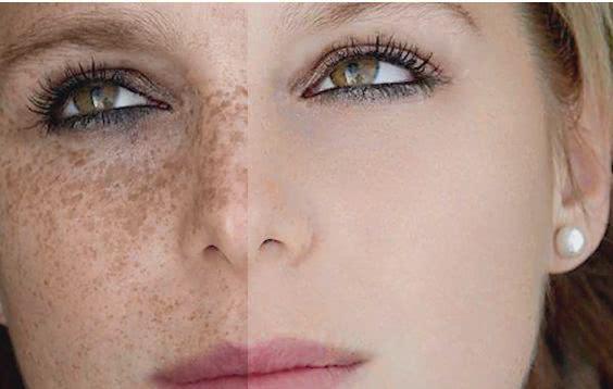 女人有没有妇科病, 一看这里就知道, 别害羞, 藏也藏不住