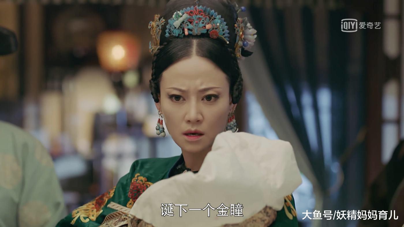 新生儿黄疸分两种, 一种要住院, 生理和病理黄疸一招巧分辨