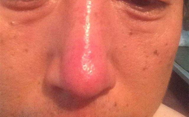 身体1处发白, 2处发黄, 2处变红, 这是肝脏在求救, 要引起警惕