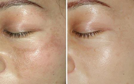 医生提醒: 百病从肝起, 身体没有“6种表现”, 恭喜你, 肝很健康