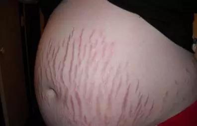 如果您怀的是女宝宝, 应该是什么样的肚型, 看看吧!