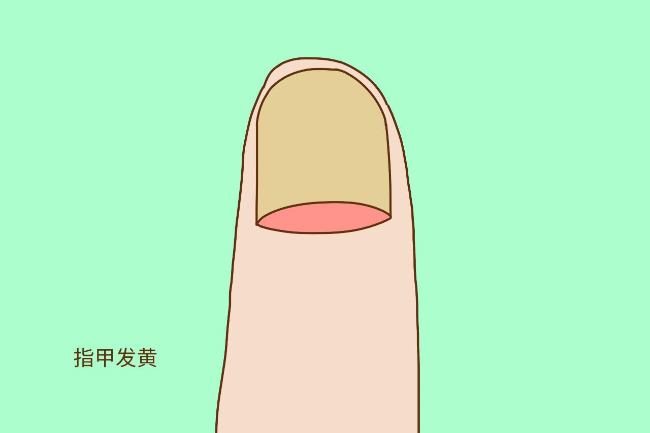 孕期贫血缺钙不自知? 准妈妈学会一招, 看懂自己“身体阴晴表”