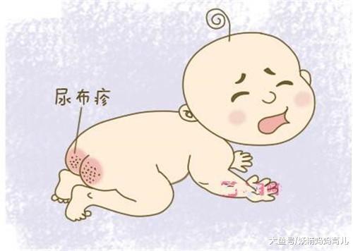 宝宝得了尿布疹怎么办? 妈妈做好这3点, 宝宝拒绝红屁股