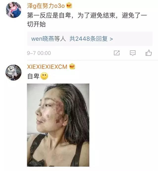 遇到喜欢的人你为什么怂了? 难以说出口的喜欢最心酸