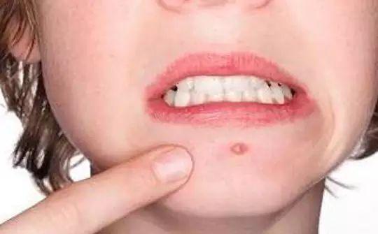 女人脸上有这4个表现, 可能是被妇科病缠上了, 需要尽快调理了