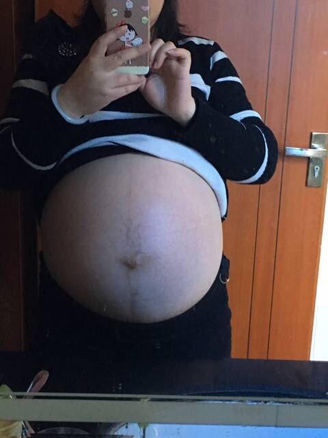 剖宫产7斤男宝一枚, 孕期肚型症状分享, 接好孕啦!