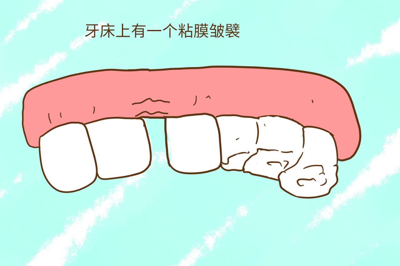孩子牙齿出现了这些问题, 就应该及时去看医生了