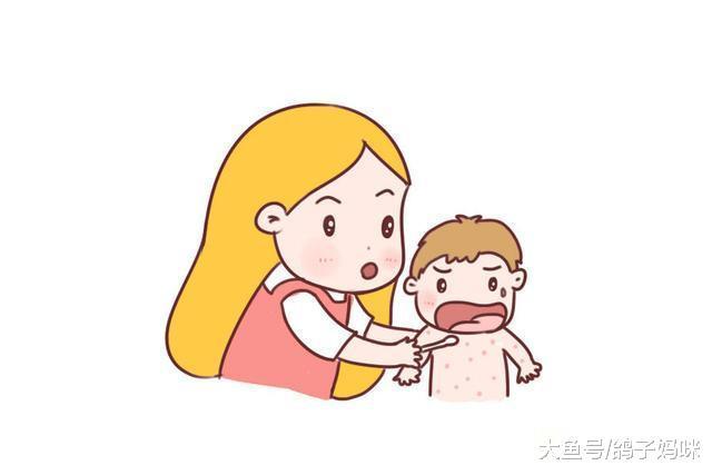 宝宝反复高烧, 当心疱疹病毒引起的玫瑰疹!