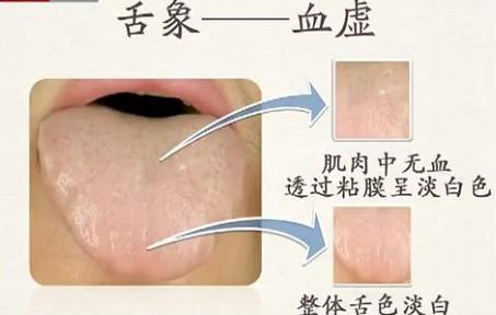 每天拍一拍, 拍掉体内湿气, 百病无, 简单易学!