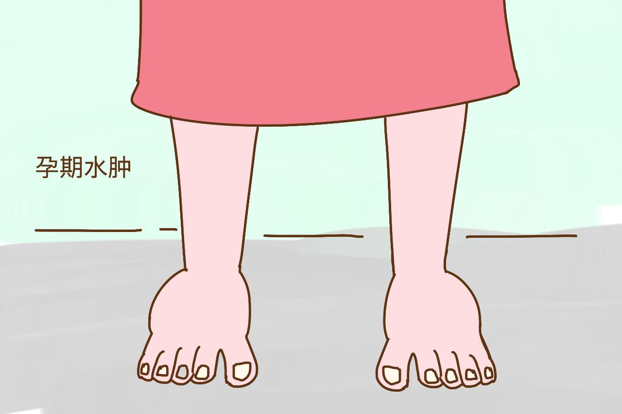 怀孕后脚水肿的厉害正常吗, 有点怕, 有和我一样的吗?