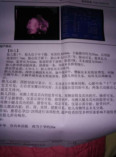 小棉袄顺利通过四维大排畸, 孕期症状分享
