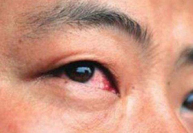 肝不好的人, 脸部可能会出现这几个变化, 看看你有吗?