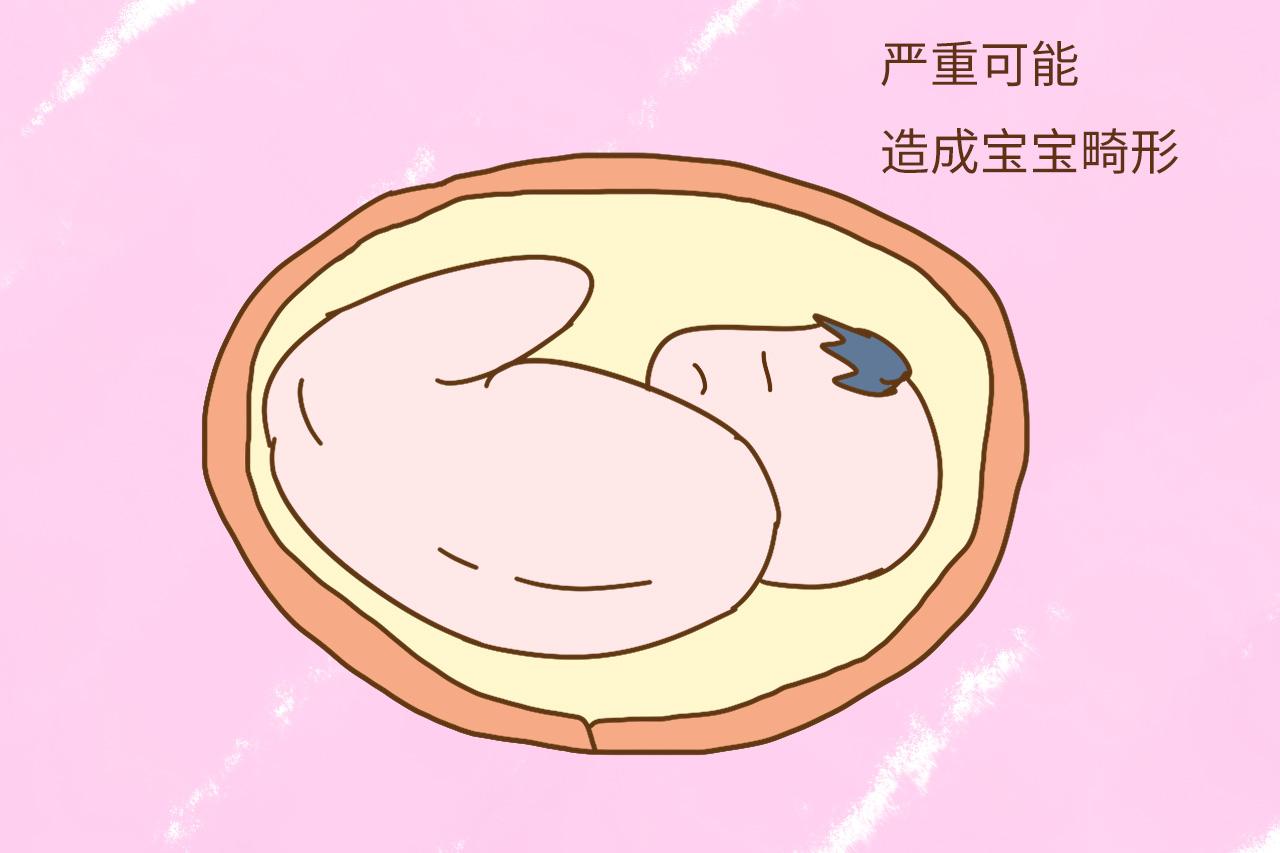不是吓唬你, 生孩子最好躲过这两个时间段, 对孕妈和胎宝真不好