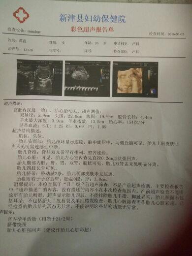 肚型看男女准吗? 我感觉还挺准吗, 分享孕期肚型及症状