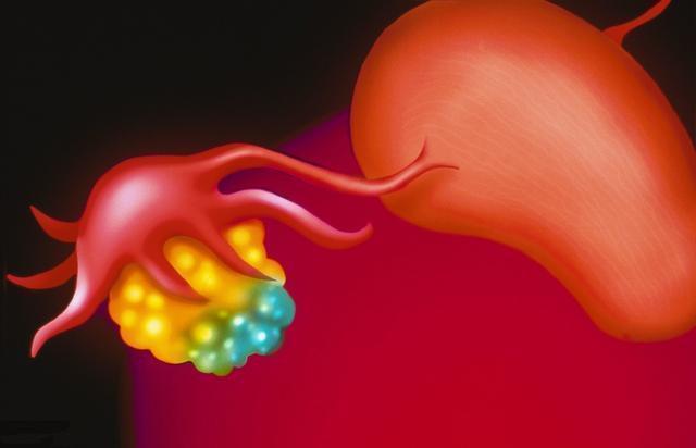 28岁女子房事后黄体破裂被送往医院, 医生解释: 都是她丈夫害的!