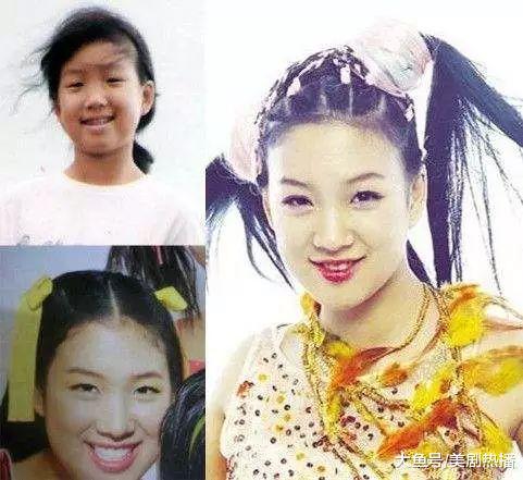 她从微笑天使到整容女王, 同时交往两人后声名狼藉, 居然还能翻盘逆袭!
