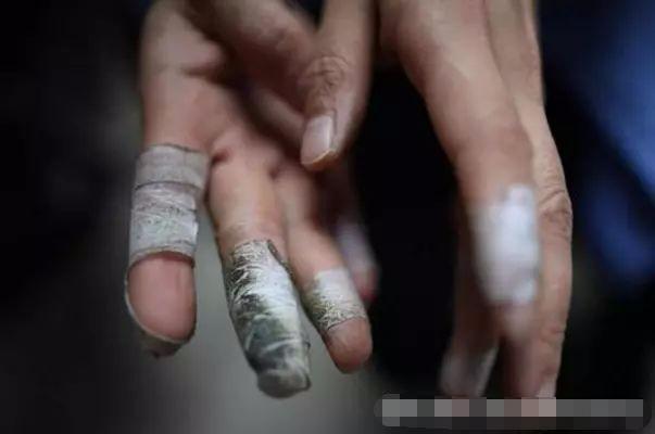 他们每天数钱数到手抽筋, 每个人手上都贴满创可贴, 对钱很厌恶