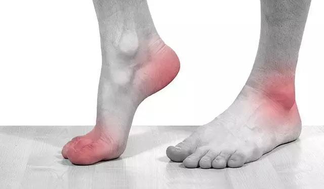 夏季痛风高发? 多做3件事, 常喝1种茶, 轻松将尿酸“逼出去”!