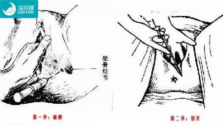 现在顺产却基本都侧切, 医生不会告诉你这些!