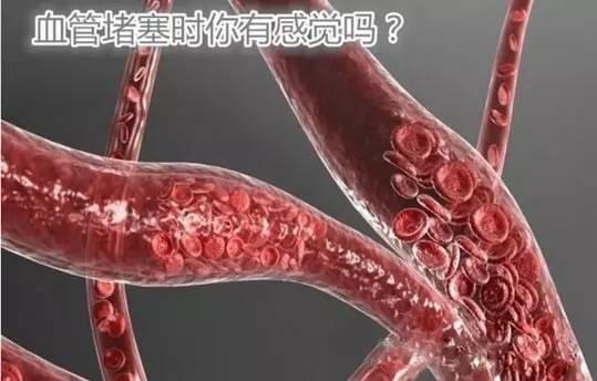 血管堵塞有多可怕? ! 医生苦劝: 别再让这6大坏习惯偷走健康!