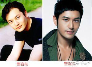 男明星整容也疯狂, 这些男明星居然都整过容?