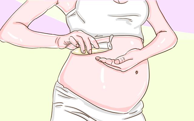 这4种孕妈是上天的“宠儿”, 很难长妊娠纹, 快看有你吗
