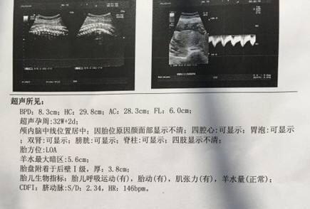 怀孕症状结合B超, 告诉你这些生男生女推测准不准!