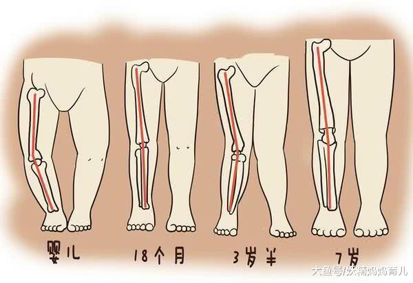 宝宝x、o型腿的3大原因, 最后两个, 多数妈妈都做过