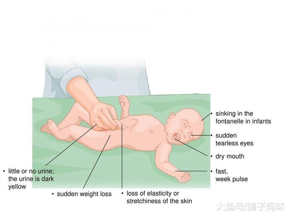 宝宝腹泻导致严重脱水, 若出现这几种状况请马上就医