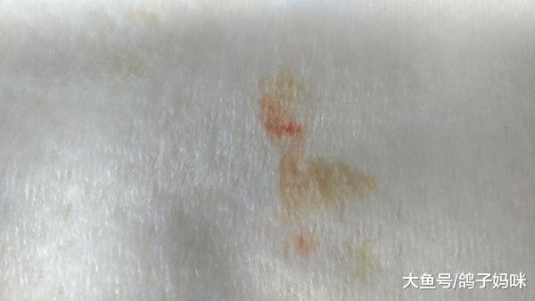 宝宝尿液中的“健康密码”, 这些妈妈平时要留意!