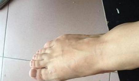 脚上出现这5种情况, 就说明你不健康了, 越早知越好!