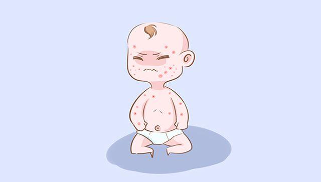 夏天出生的宝宝面临的困扰多, 这才是萌娃夏季打开的正确方式
