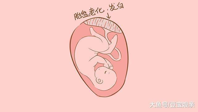 想知道胎儿营养够不够? 看胎盘级别就知道