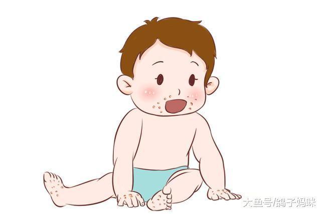 儿科医生经验总结, 手足口病高发季节预防大全!