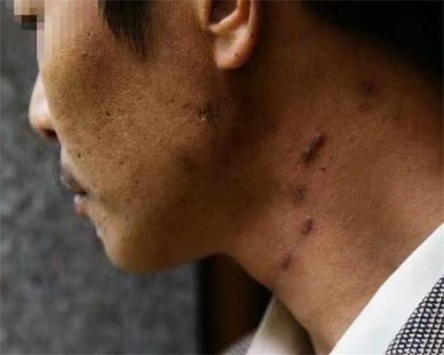 男友娶越南媳妇回家, 没想到全家都染上了这个病