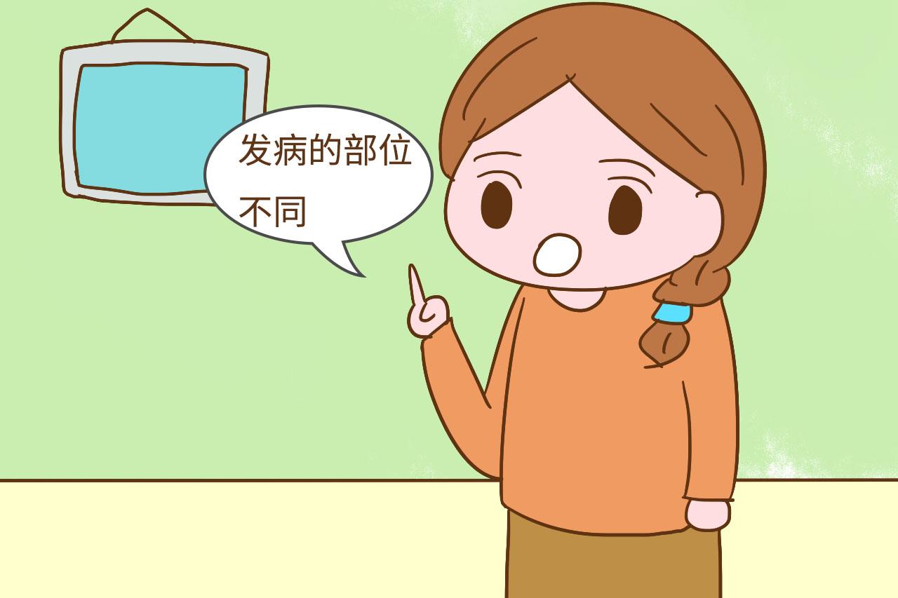 湿疹、小儿急疹、痱子长得太像分不清? 这几个区别能帮到你