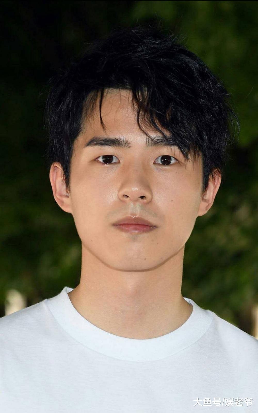 明星的皮肤也有这么多小瑕疵, 最后一个甚至有点吓人?