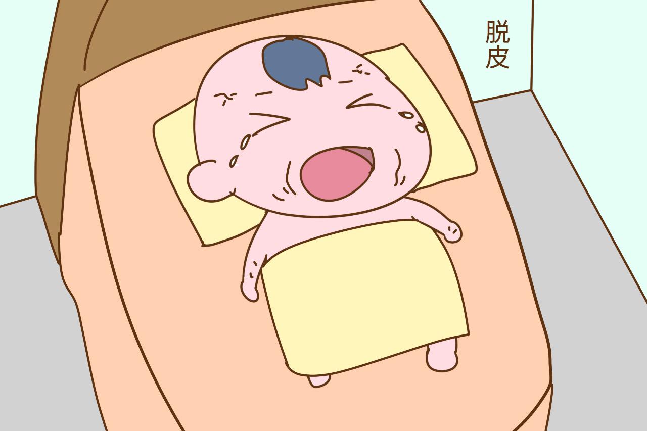 刚出生的宝宝, 会有这些特殊的生理现象, 看看你家有没有?