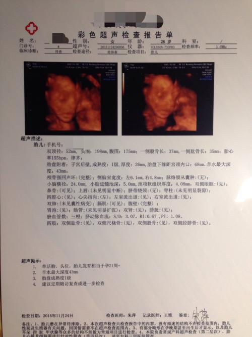 整个孕期做了好几次四维, 那些数据真的可以判断男女吗?