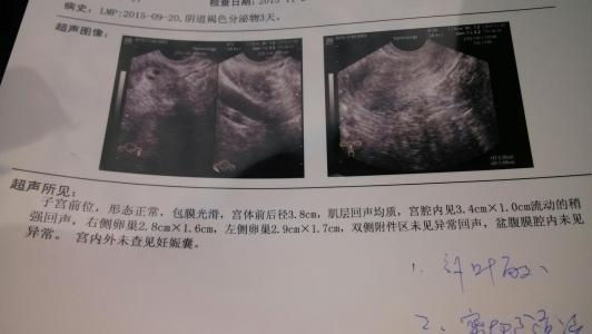 孕囊大小预测生男生女准吗?