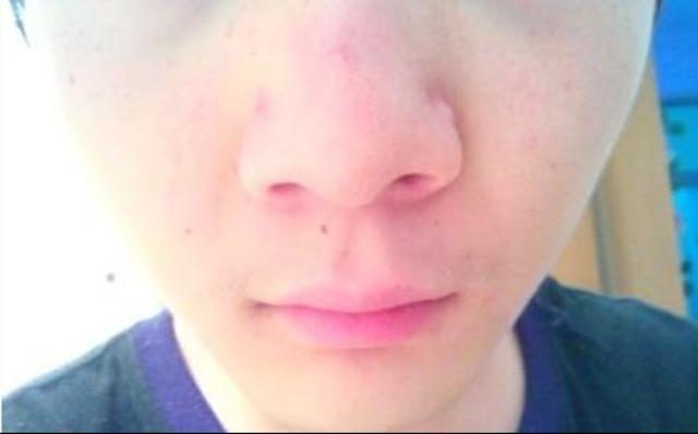 男人晨起, 如果没有出现4个症状, 恭喜, 你的身体还算健康